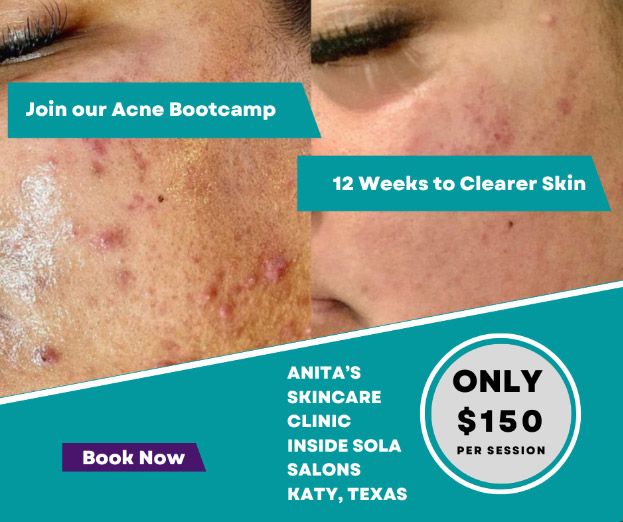 Face Reality Acne Bootcamp Program