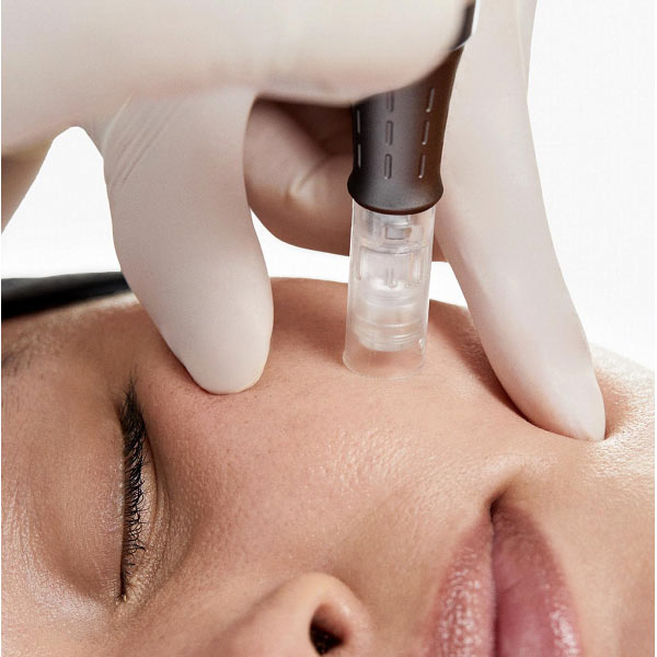 Acne Scar Microneedling