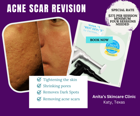 Acne Scar Revision