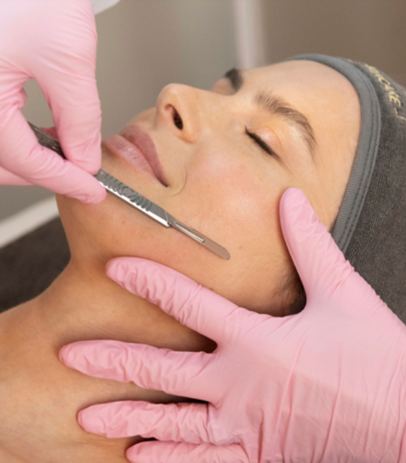 Dermaplaning Facials Unveiled: Benefits and Side Effects You Should Know 