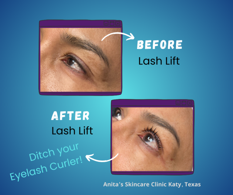 Lash Lift Vs Lash Extensions Which Is Right For You Skin Care